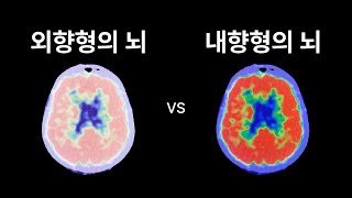 E와 I는 뇌의 구조부터 다르다