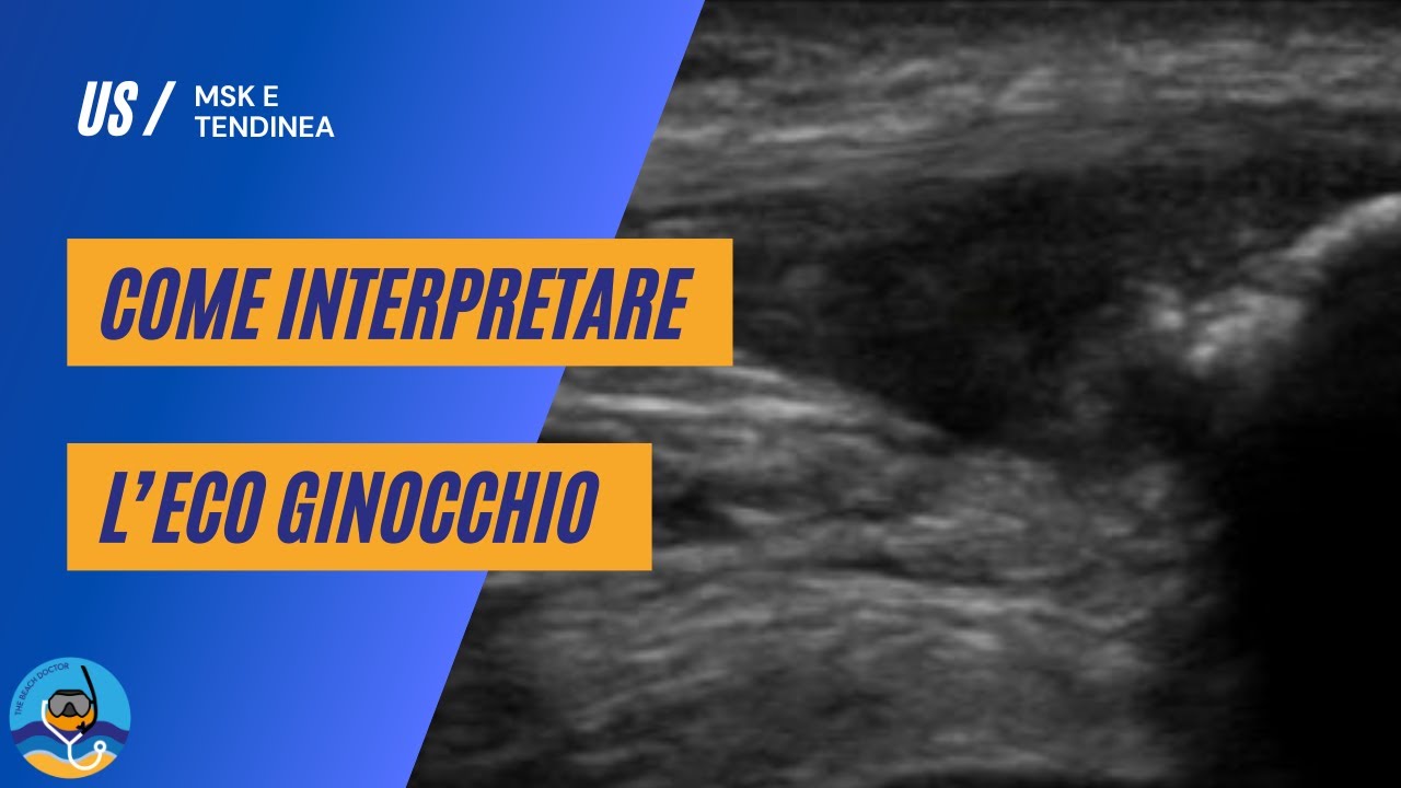 Come interpretare l'ecografia del ginocchio?