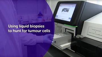 Using liquid biopsies to hunt for tumour cells | Cancer Research UK
