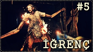 BÖYLE DE İĞRENÇ OLUNMAZ Kİ | Resident Evil 7 : Biohazard