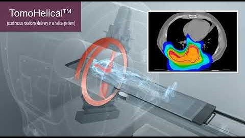The #TomoTherapy System vs Conventional Linacs