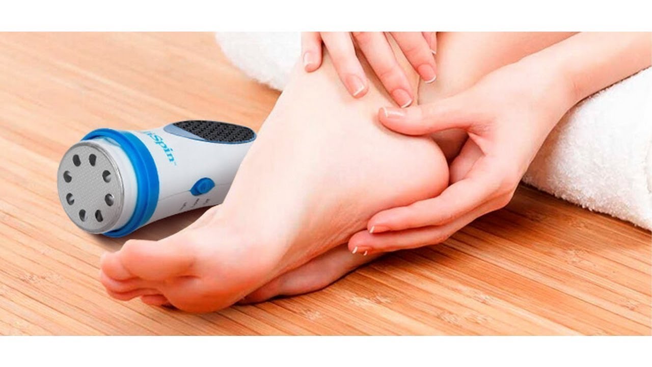 Мозоль на ступне больно наступать как удалить - YouTube