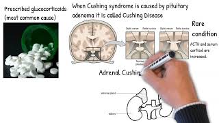 Cushing