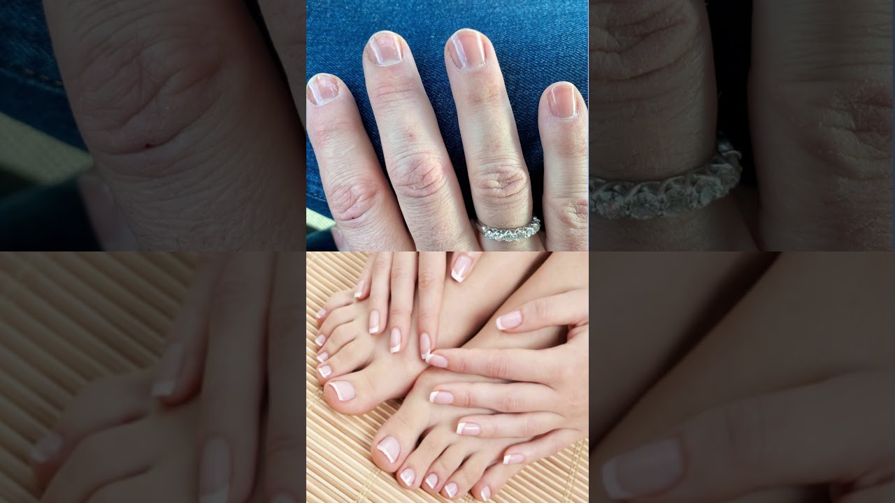 Are you suffering from nail problems? Metanail complex honest review | made in #usa #short #review