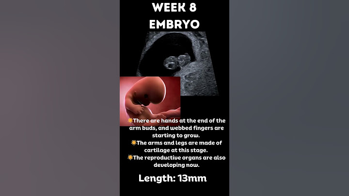 Amazing 😍Pregnancy 8 week embryo 3D animation and ultrasound   #pregnancyultrasound