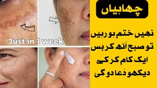 Freckles removal morning routine| how to get rid of freckles naturally