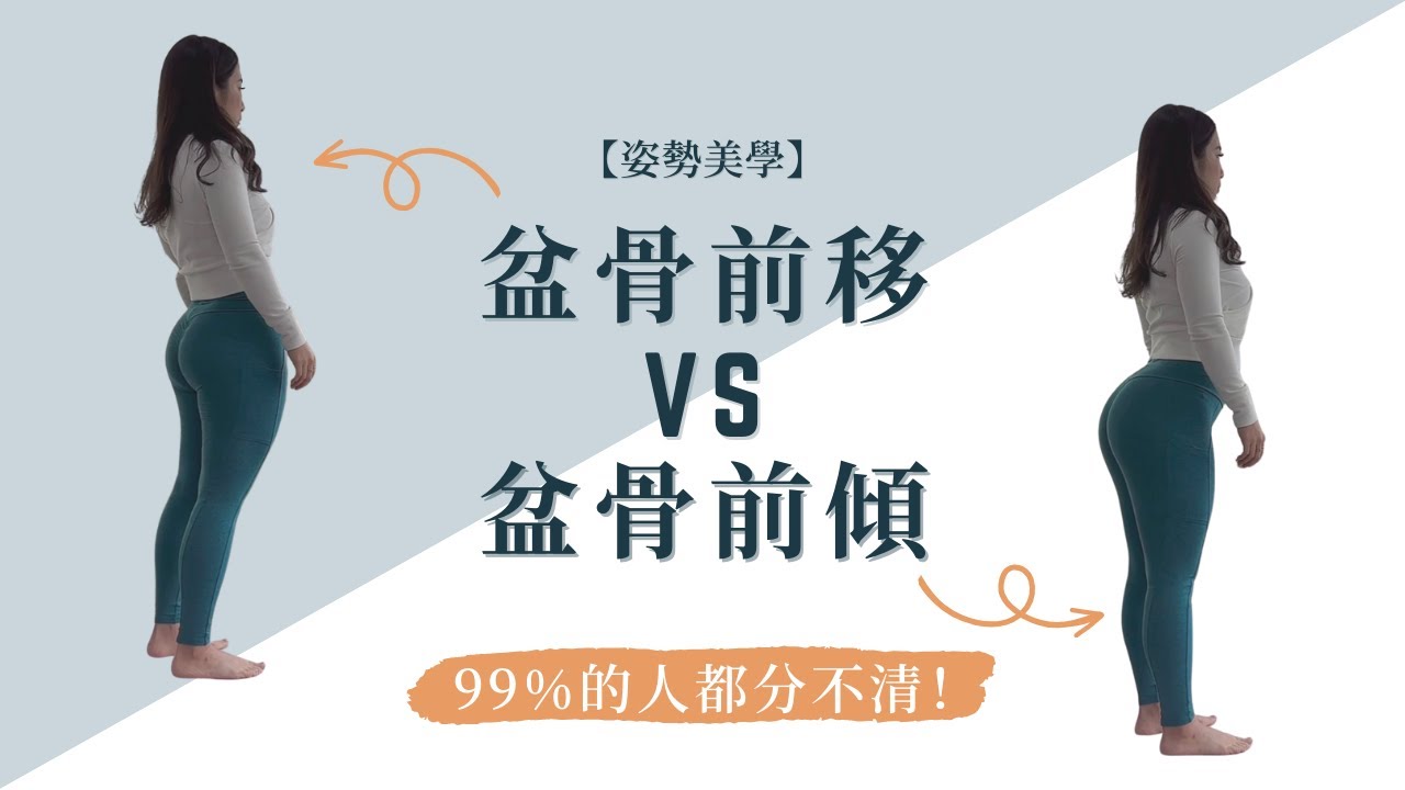 【姿勢美學】99%的人都分不清－誤把盆骨前移當成是盆骨前傾，亂矯正越改越差⋯ - YouTube