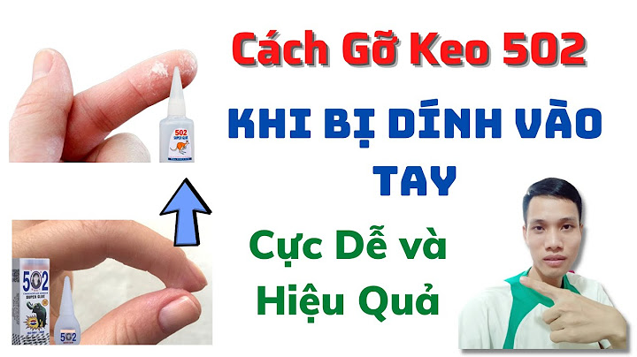 Làm thế nào khi bị keo 502 dính vào tay