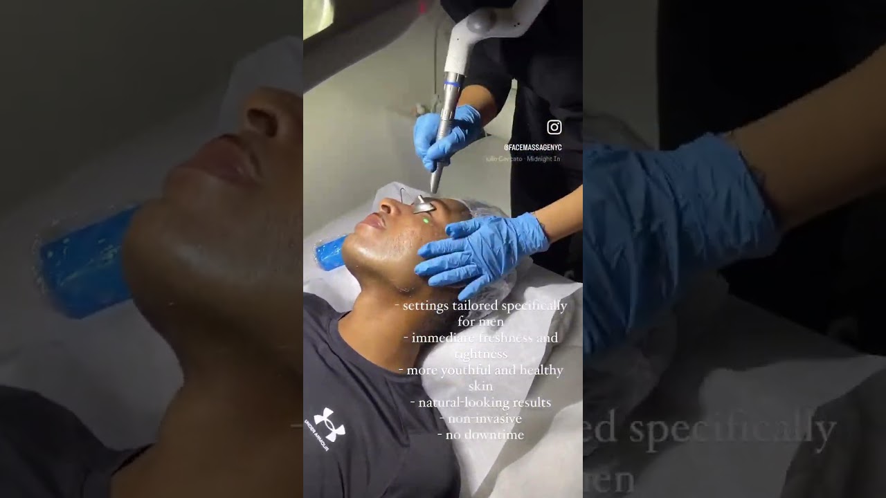 INSTANT GLOW UP FOR MEN WITH FOTONA 4D!