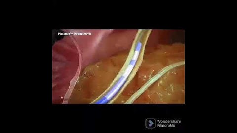 Habib EndoHpB|Bipolar Radiofrequency catheter Setup and uses#nursesLife #ytvideo