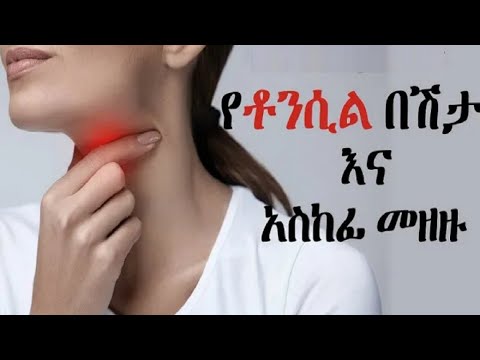 ቪዲዮ: ሊምፍ ኖዶች ይገኙ ነበር?