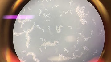 C Elegans Wild Type (N2)