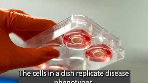 Retinal cells in a dish replicate disease phenotypes