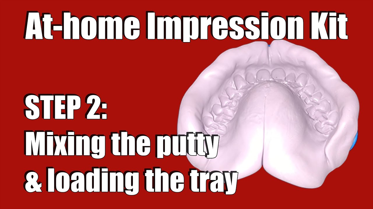 1 Set Dental Teeth Impression Kit Teeth Molding Kit Teeth