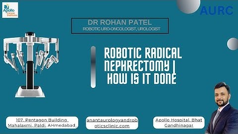 Robotic surgery for Kidney Cancer (Nephrectomy) | How is it done? | Dr. Rohan Patel | Uro-Oncologist