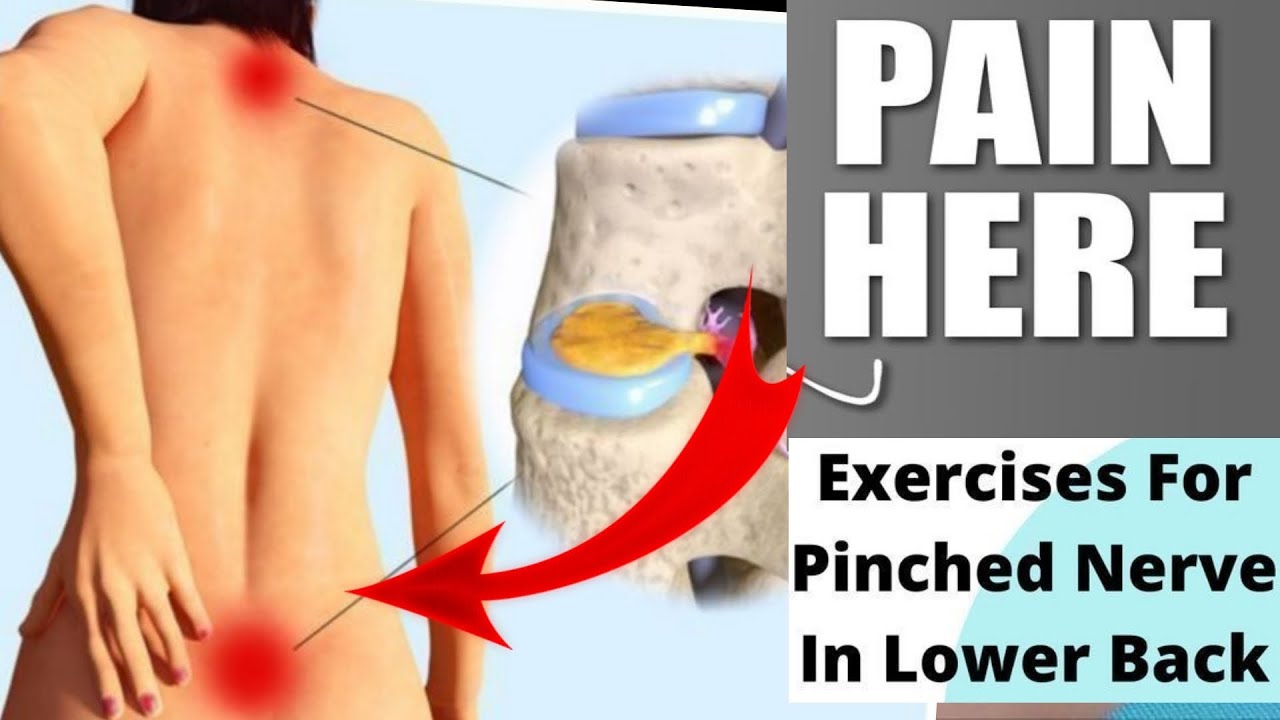 disc-bulge-treatment-l4-l5-s1-herniated-disc-treatment-3-day