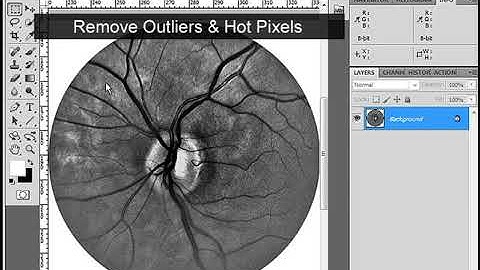 Noise Reduce Remove Outliers Microscope Images