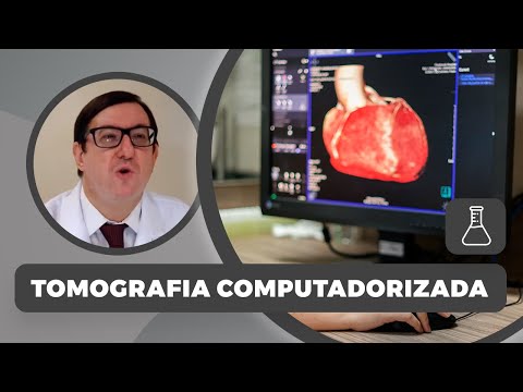 Vídeo: Imagem Na Gota - O Que Podemos Aprender Com Ressonância Magnética, Tomografia Computadorizada, DECT E EUA?