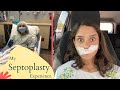 my septoplasty experience!