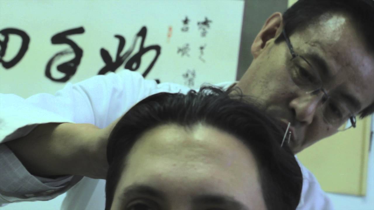 Acupuncture for Paralysis YouTube
