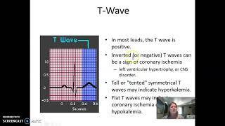 Telemetry Monitoring and wave forms