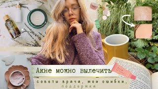 Как Справиться с Акне? Интервью с Врачом, Моя История, Поддержка