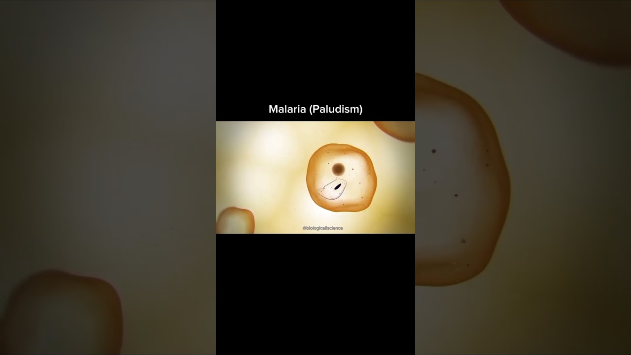 Real-time visualization of malaria