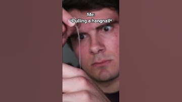 Thumbnail of Pulling Back A Hangnail Be Like: