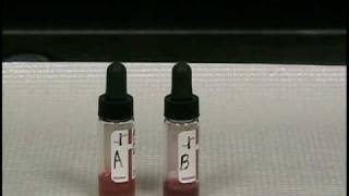 ABO Rh Group Typing Tube Method.wmv