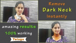 How To Get Rid Of Dark Neck Instantly In Telugu || 100% Works || How To Remove Dark Neck Instantly||