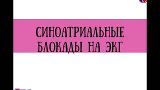 Синоатриальные блокады на ЭКГ (СА блокады) - meduniver.com