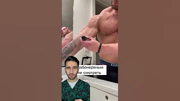 эти вены мечта для любой медсестры