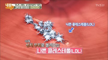 강력한 혈관 암살자 ‘호모시스테인’ [내 몸 사용설명서] 185회 20171229