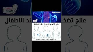 علاج تضخم الطحال عند الاطفال مركز د/احمد الشامي*استاذ جراحة الاطفال وحديثي الولادةوالتشوهات الخلقية