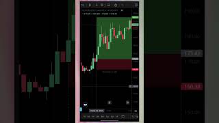 Stock options Trading Live - intraday trading live shortsvideo tradingstrategy