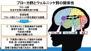 No18. 失語理解に必須！理学療法士が解説する言語理解のメカニズム ～ウェルニッケ野とブローカ野の関係性～