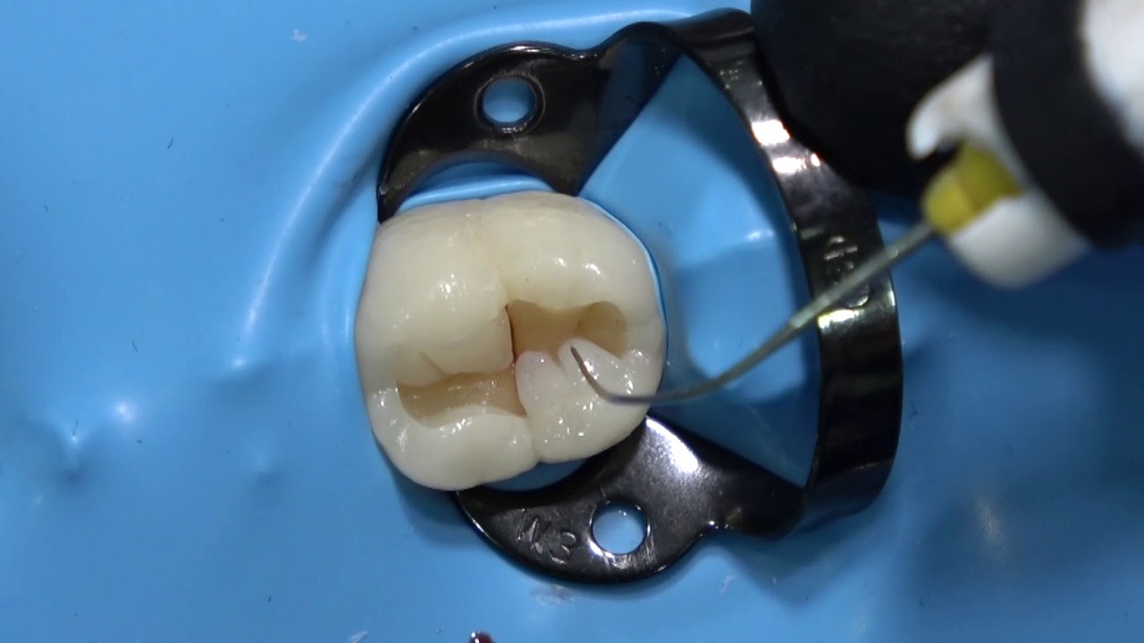 DIRECT COMPOSITE CLASS 1