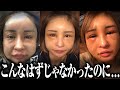 私の可愛い顔を返してください。