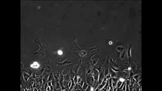 gene p53.FLV