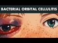 BACTERIAL ORBITAL CELLULITIS