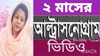 ২ মাসের একটি প্রেগনেন্সি আল্ট্রাসনোগ্রাম ভিডিও দেখে নিন