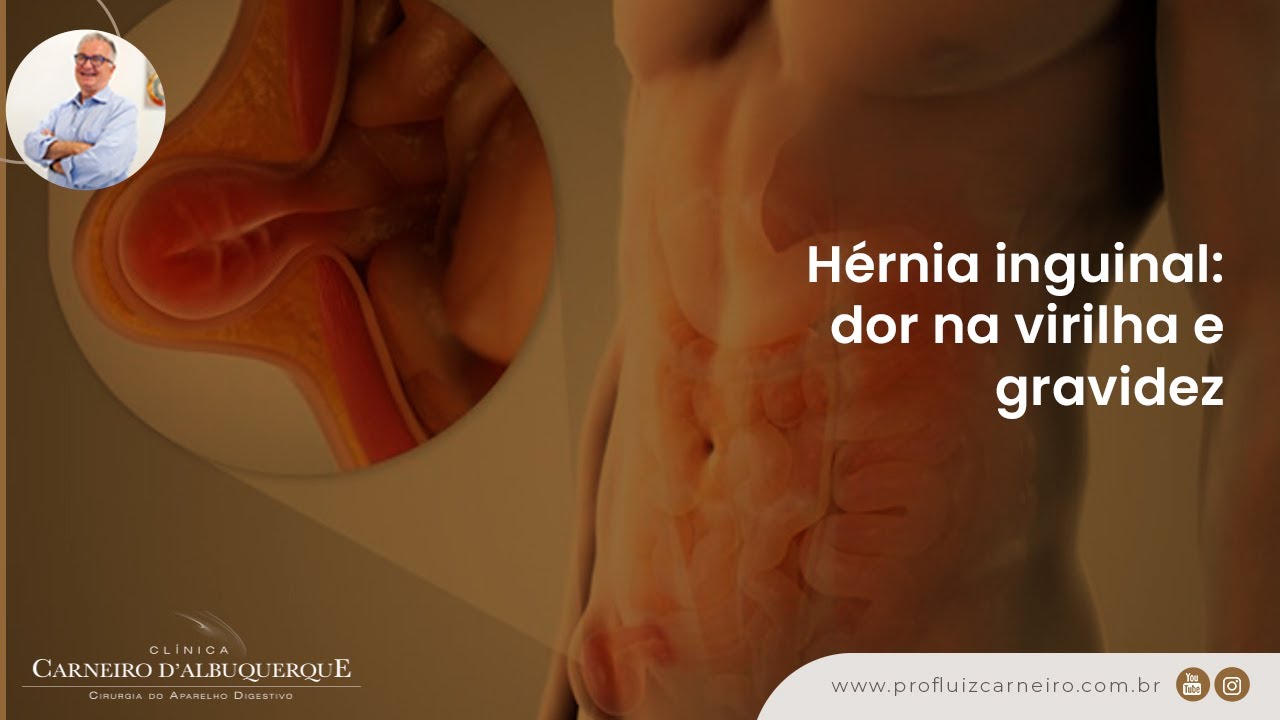 Es bueno andar después de operación hernia inguinal