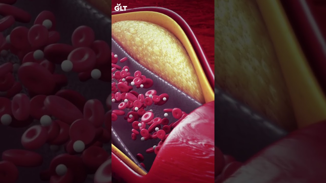 What Happens If You Eat Flax Seeds Daily