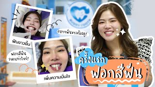 รีวิว ฟอกสีฟันครั้งแรก ผลลัพที่ได้ !? | Nancepapai