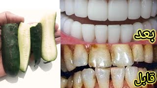 تبييض الاسنان في المنزل  دقيقتين فقط ستحصل على اسنان بيضاء مثل اللؤلؤ وصفة مجربة في تبييض الأسنان