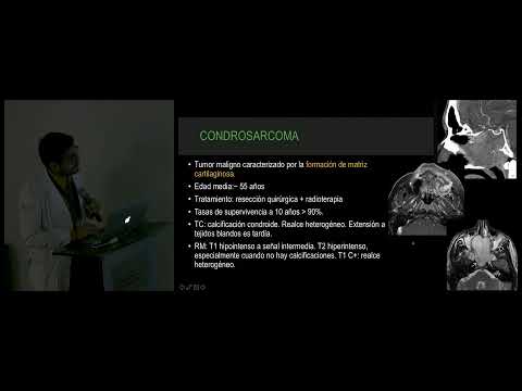 Vídeo: Investigación De Vías EZH2 Para Nuevas Estrategias De Tratamiento Epigenético En Cáncer De Orofaringe