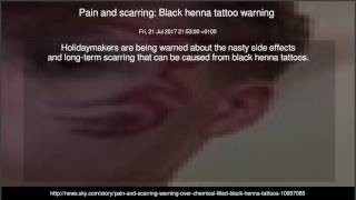 Pain and scarring Black henna tattoo warning