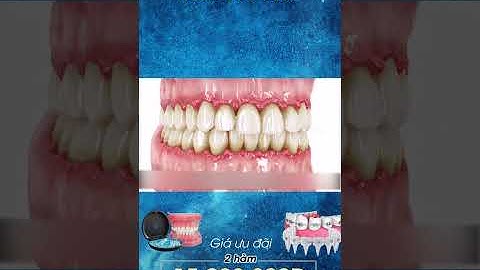 [3D] RĂNG HƯ TỔN || Nha Khoa Quốc Tế Athena