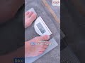 Is Your BMI Over 37.5? Here’s Why You Should Consider Bariatric Surgery | Dr. Lakshmikanth