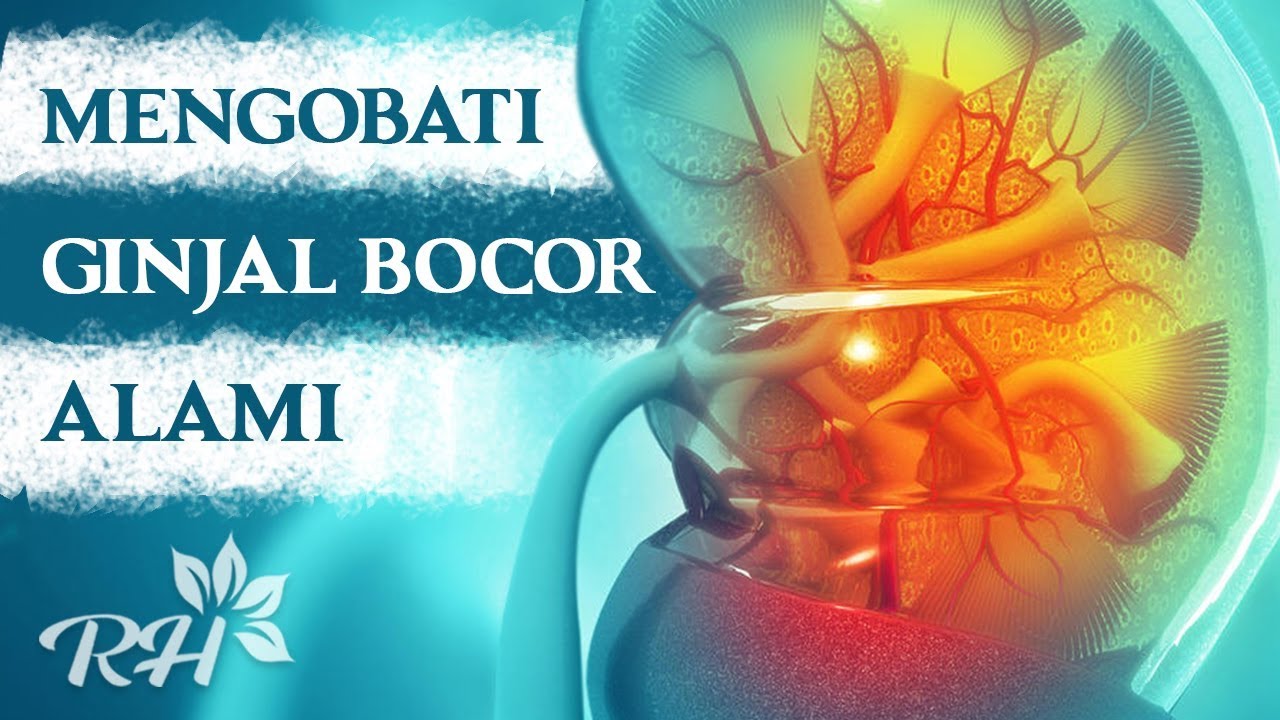 Cara Mengobati Ginjal Bocor Secara Alami - Cepat Tanpa Efek Samping
